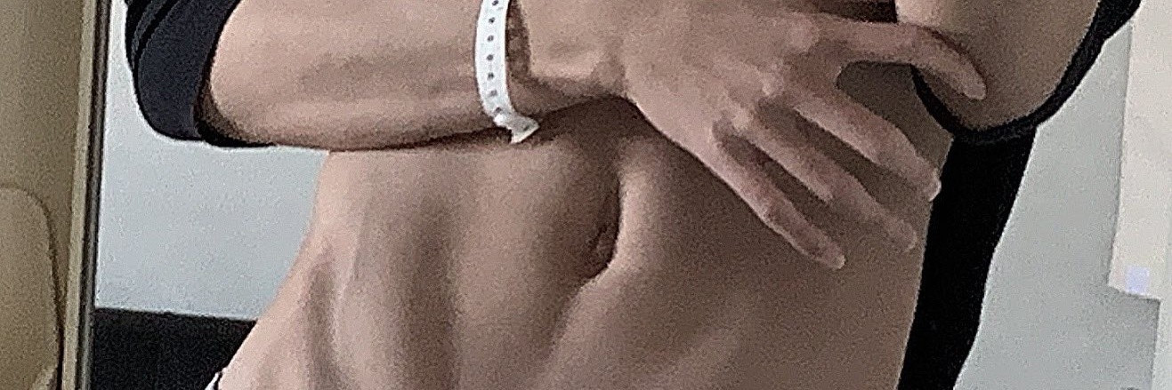 はり