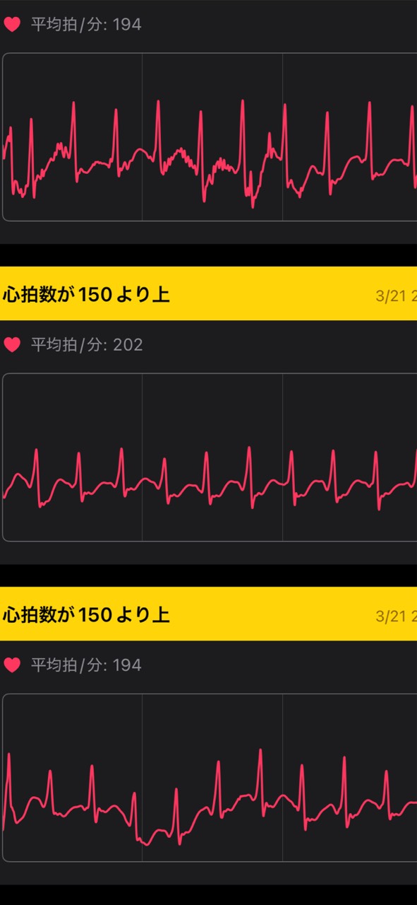 ♡̴心肺停止