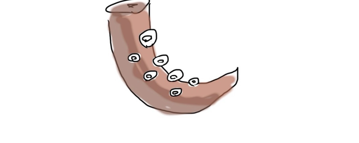 ｹﾞﾝ